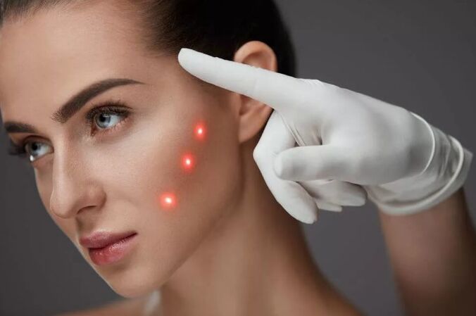 Laser renovation of the skin